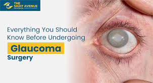 Glaucoma Treatment